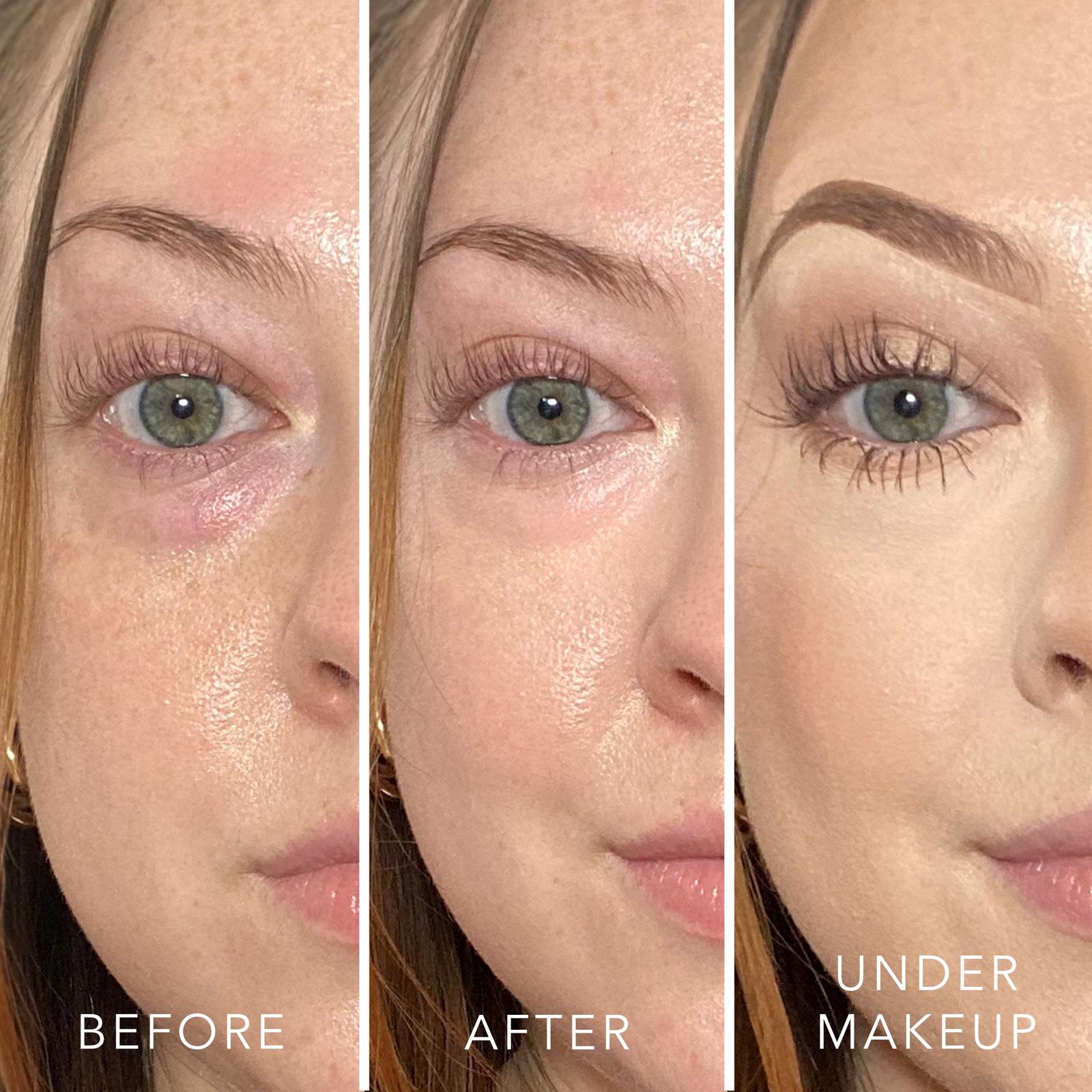 T.C.E This Corrects Everything Luminous Undereye Corrector - Rose Quartz