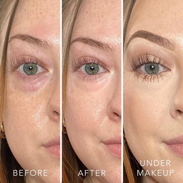 Doll 10 T.C.E This Corrects Everything Luminous Undereye Corrector #3