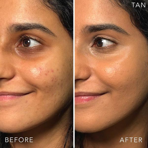 Doll 10 T.C.E This Covers Everything Super Coverage Concealer With Peptides #3