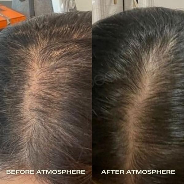 Luna Nectar Atmosphere Multi-Peptide Hair Density & Scalp Serum #4
