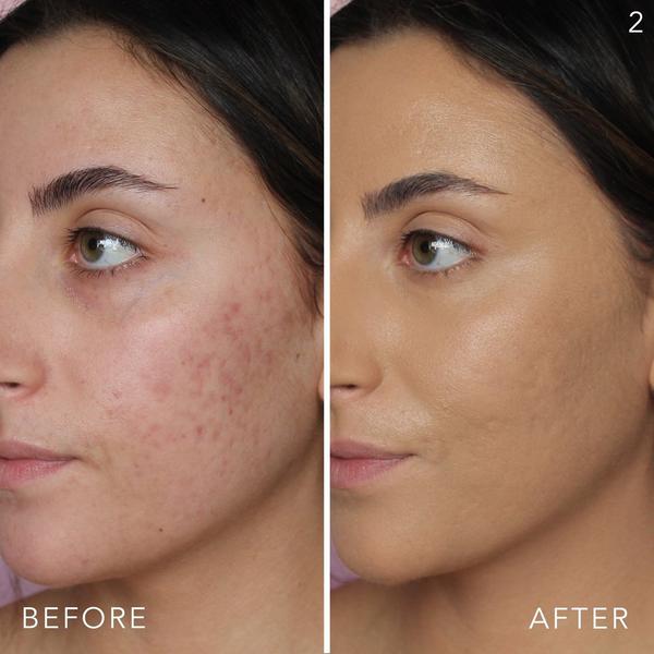 Doll 10 Doll Skin Genius Tinted Moisturizer With Niacinamide #3