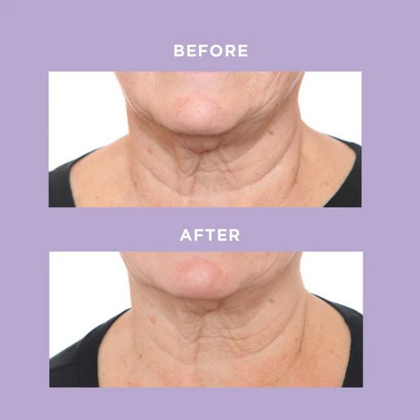 PRAI Beauty Ageless Throat & Decolletage Day & Night Duo #4