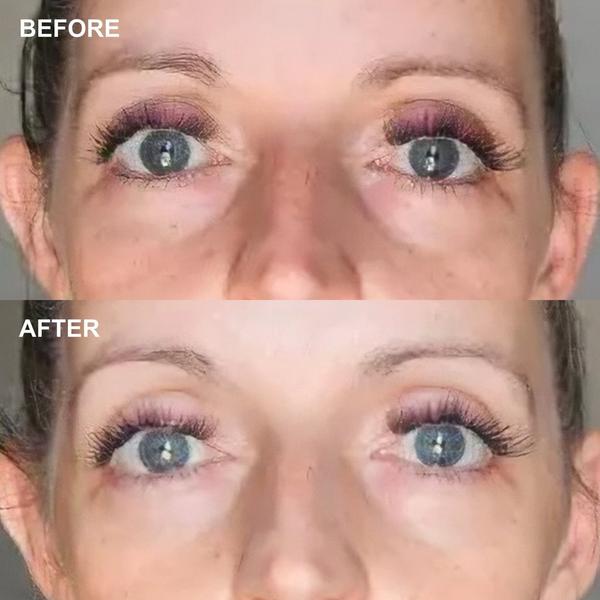 Wrinkles Schminkles Eye Smoothing & Depuffing Sheet Mask - 5 Pack #3