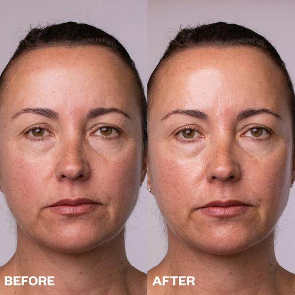 Wrinkles Schminkles Face, Neck & Décolletage Peel Pads #3