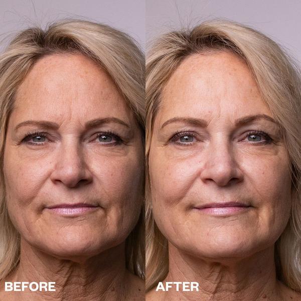 Wrinkles Schminkles Face, Neck & Décolletage Peel Pads #6