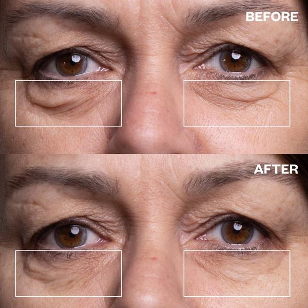 Wrinkles Schminkles Eye Wrinkle Patches - 1 Pair #3