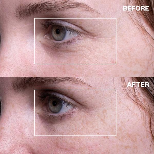 Wrinkles Schminkles Eye Wrinkle Patches - 1 Pair #5