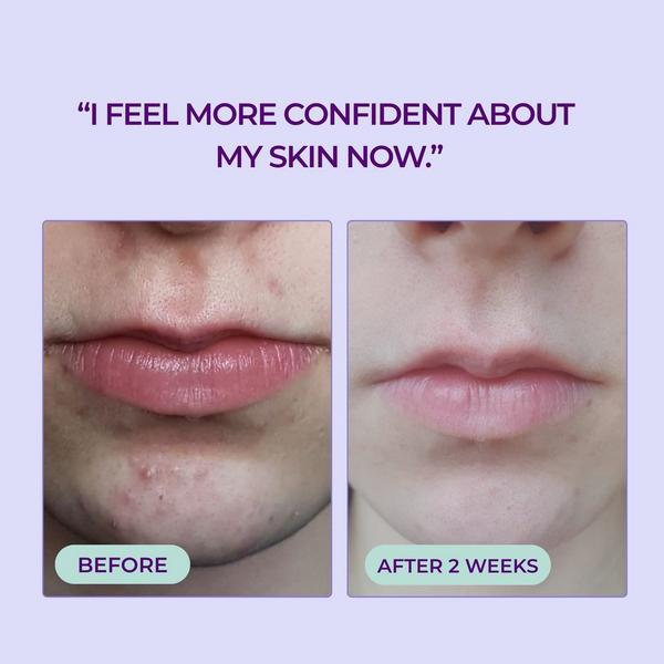 Evre Skincare Do Your Thing AHA & BHA Gel Cleanser for Oil Control for Teens #2