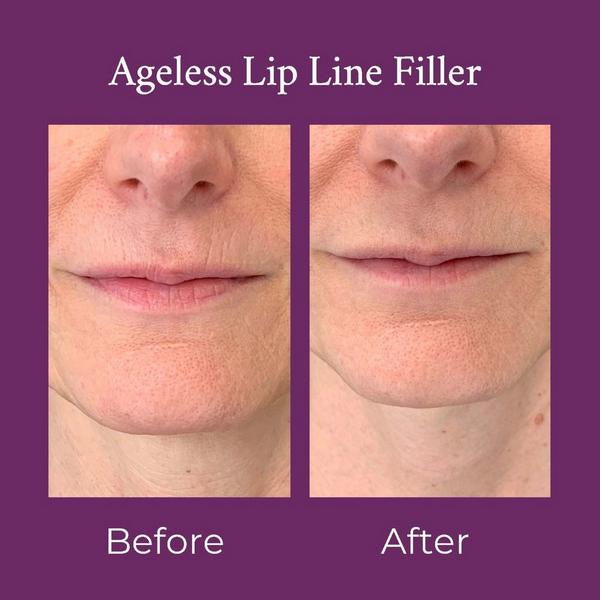PRAI Beauty Ageless Lip Line Filler #3