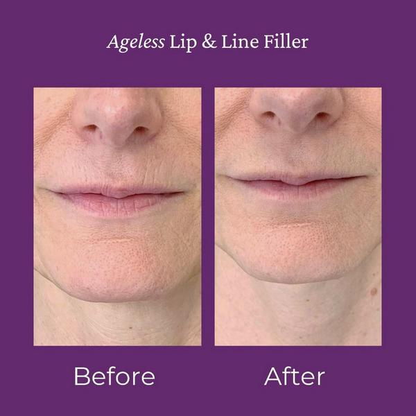 PRAI Beauty Ageless Lip & Line Filler #5