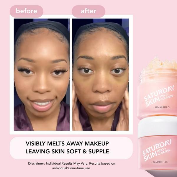 Saturday Skin Melt + Cleanse Makeup Melting Balm #8