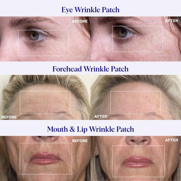 Wrinkles Schminkles Eye, Forehead & Mouth Wrinkle Patches Multi-Pack #4