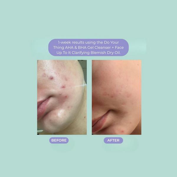 Evre Skincare Large Clearing Skincare Set #7