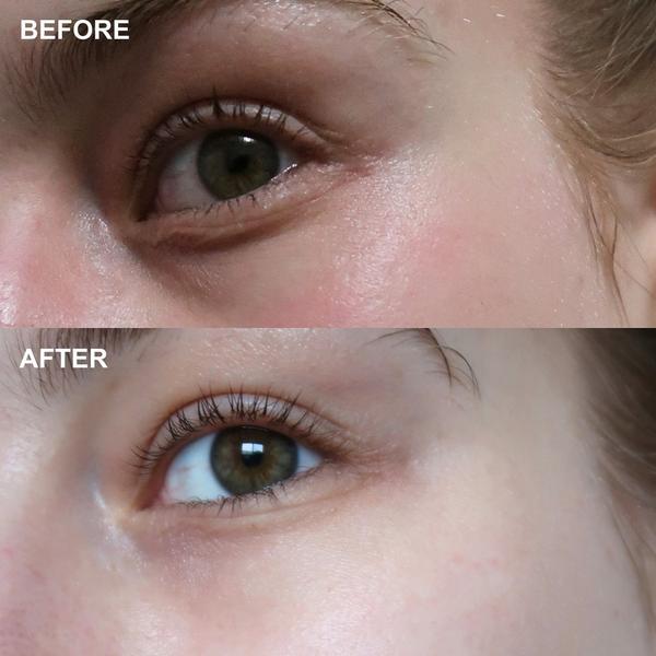 Wrinkles Schminkles Self-Dissolving Microneedle Patches #6