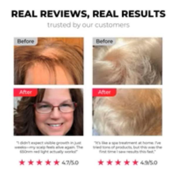 TYMO Beauty TriThera Hair Brush #7