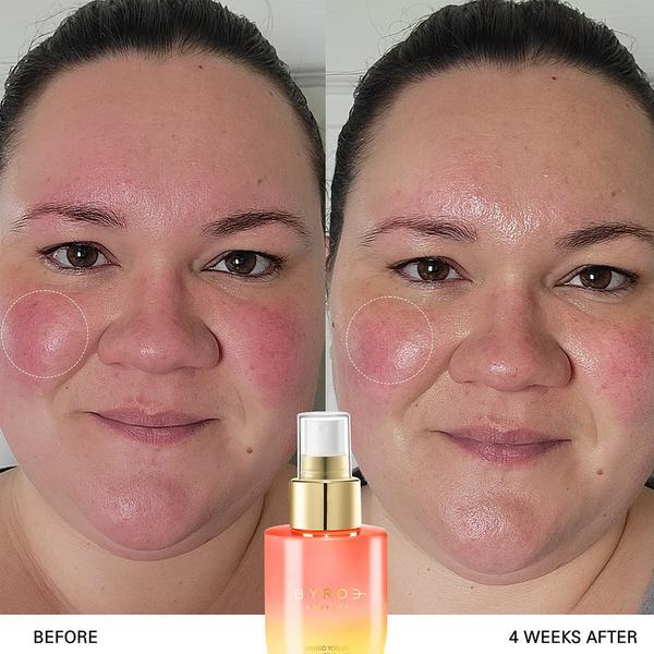 BYROE Mango Yogurt Balancing Mist #4