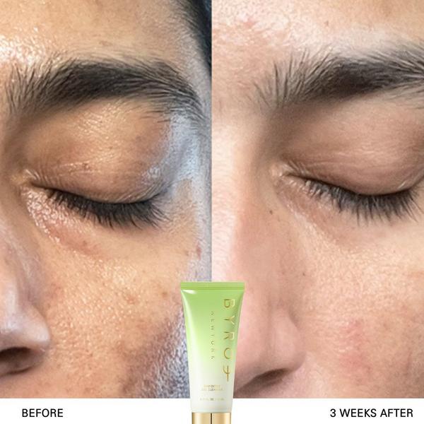 BYROE Kiwi Detox Gel Cleanser #5