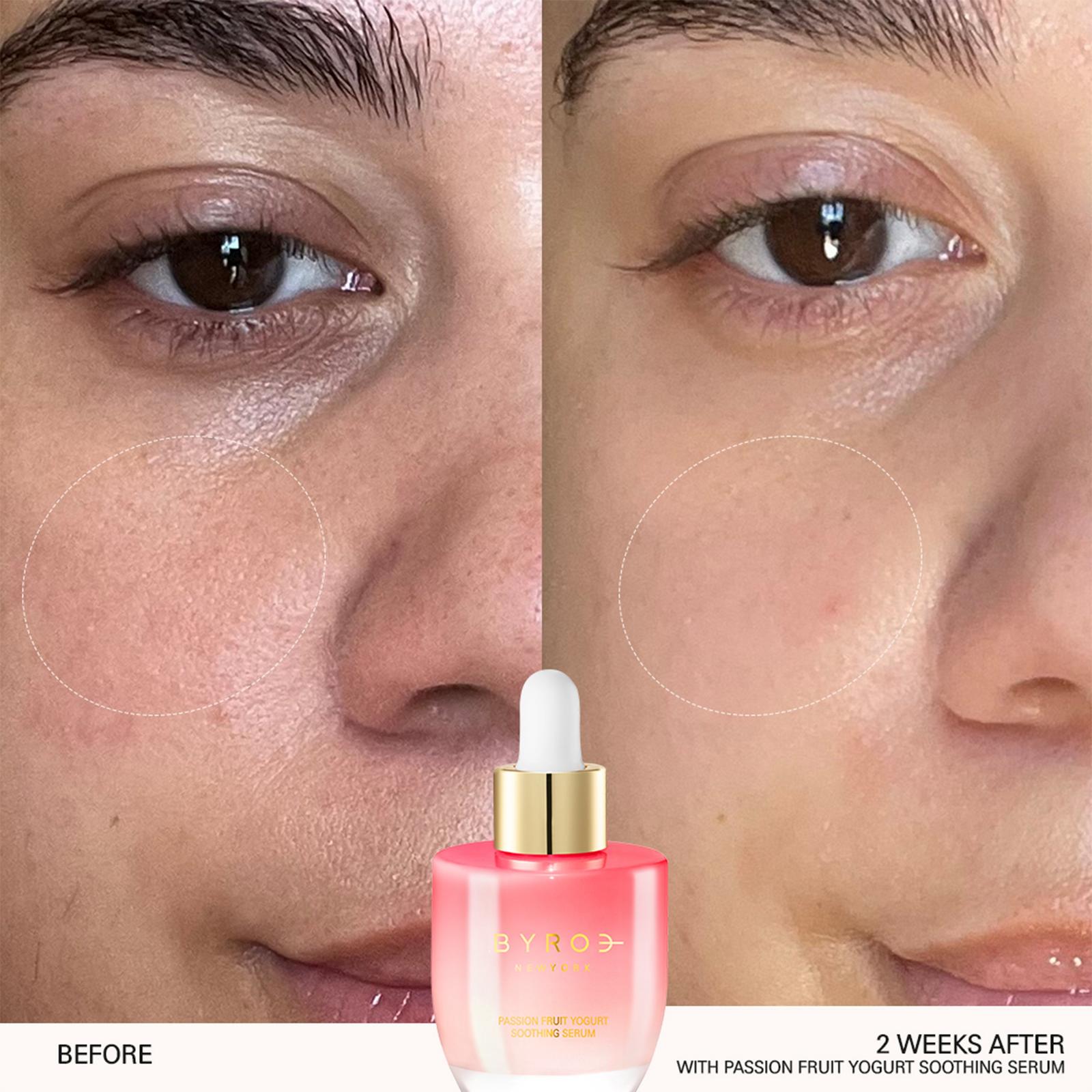 Passion Fruit Yogurt Soothing Serum
