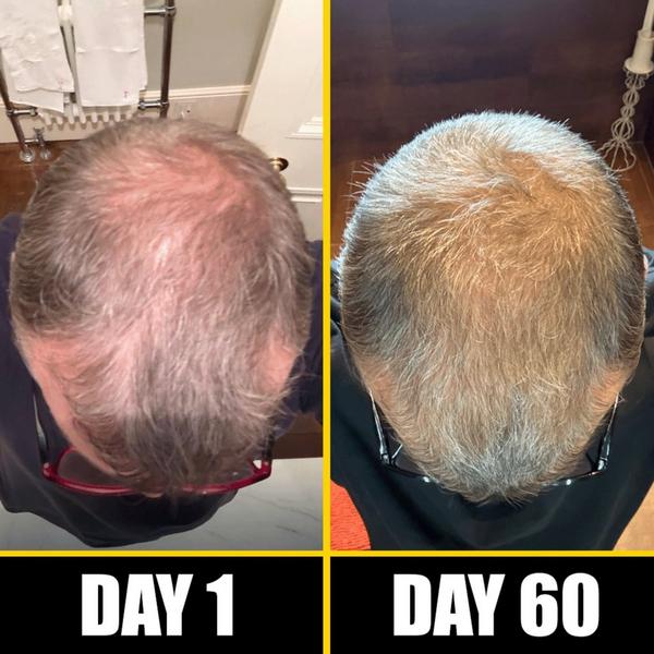 Pete & Pedro BOOST Scalp & Hair Strengthening & Growth Oil (With Rosemary & Biotin) #5