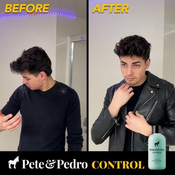 Pete & Pedro CONTROL Extra-Strength Dandruff & Anti-itch Shampoo #3