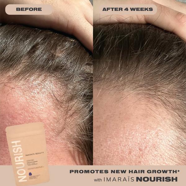 Imarais Beauty NOURISH Haircare Gummies for Hair Growth, Anti-Shedding #5