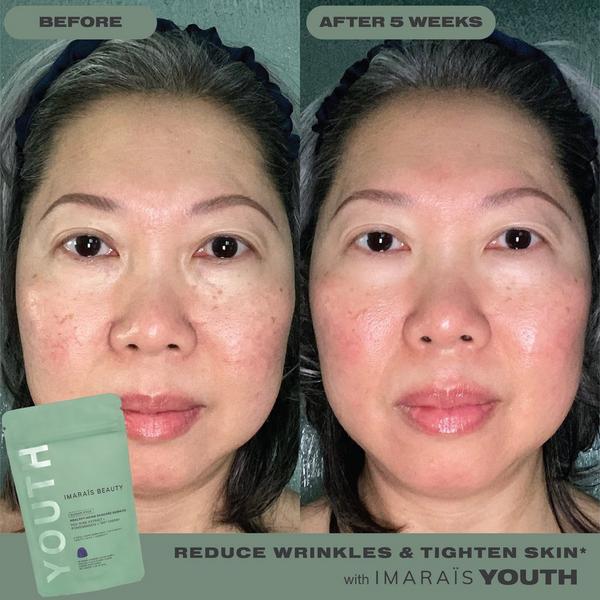 Imarais Beauty YOUTH Anti-Aging Gummies for Wrinkles, Discoloration #5