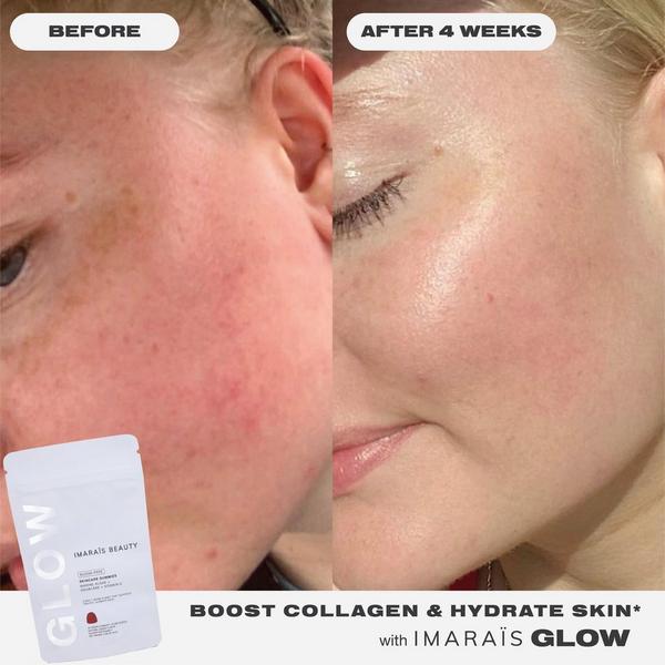 Imarais Beauty GLOW Skincare Gummies for Hydration, Collagen Boosting #5