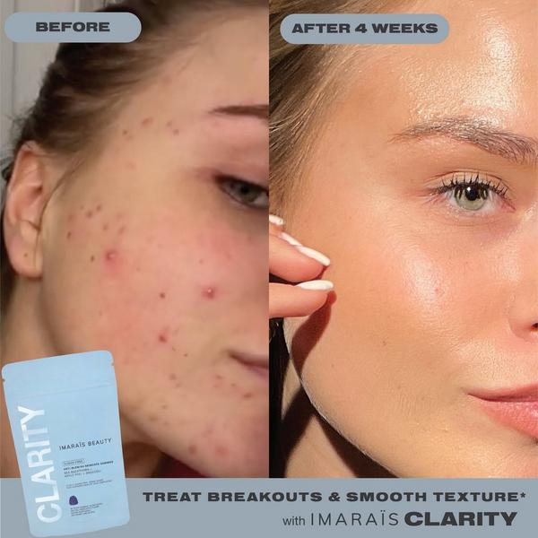 Imarais Beauty CLARITY Anti-Blemish Gummies for Clear Complexion #5
