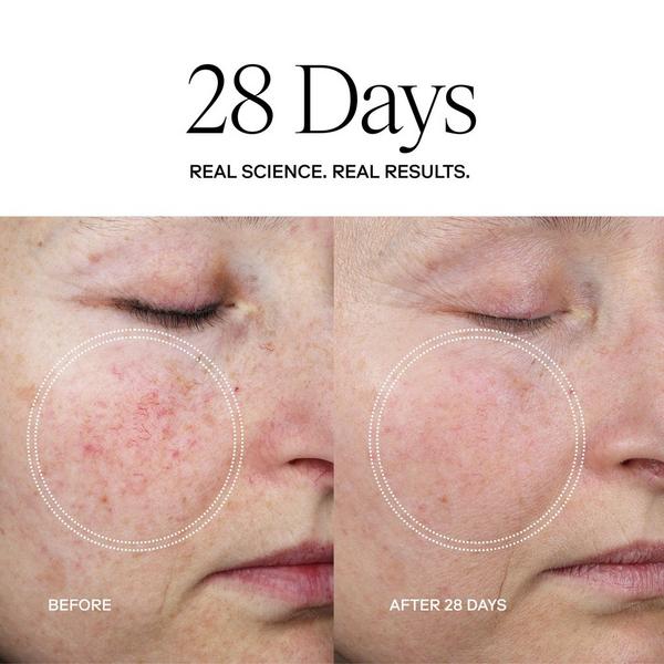 Exoceuticals EXO PLUS Anti-Aging Cream #6