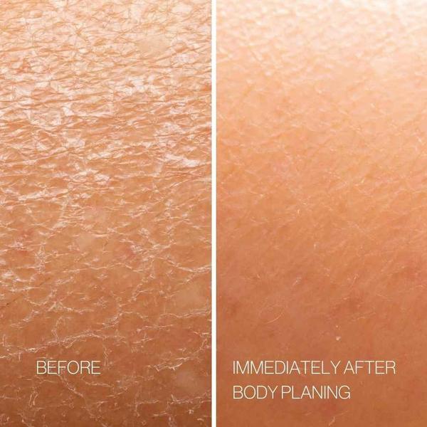 Esker Beauty Nourishing Body Plane Set #4