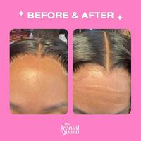 The Frontal Queen Lace Melting Spray #3