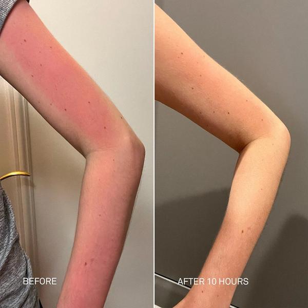 RescueMD Body Recovery Set #3