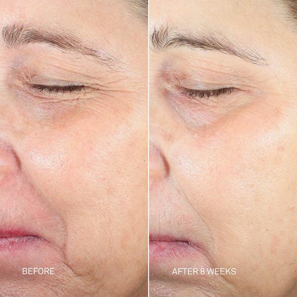 RescueMD Skin Longevity Nighttime Oil #4