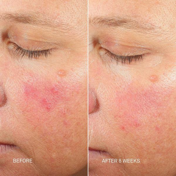 RescueMD Skin Longevity Nighttime Oil #5