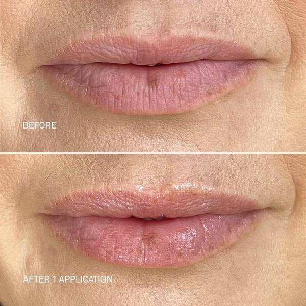 RescueMD Restorative Lip Treatment #4
