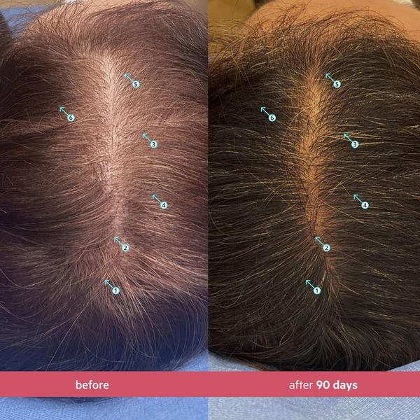 DS Laboratories Spectral Women's 3 Month Serum with Nanoxidil 5% #4