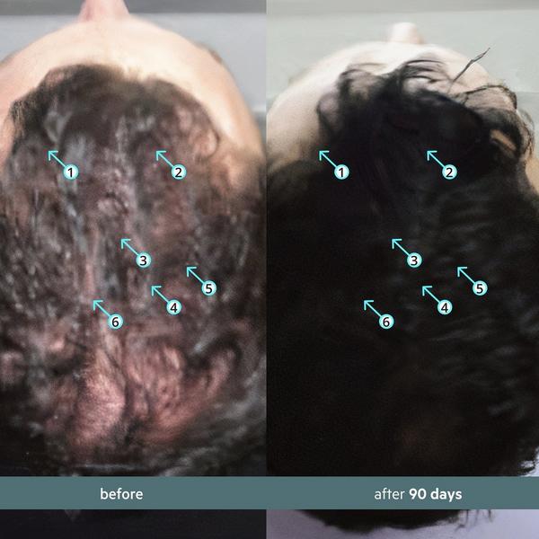 DS Laboratories Spectral.CBD Hair Serum with CBD + Nanoxidil 5% #4