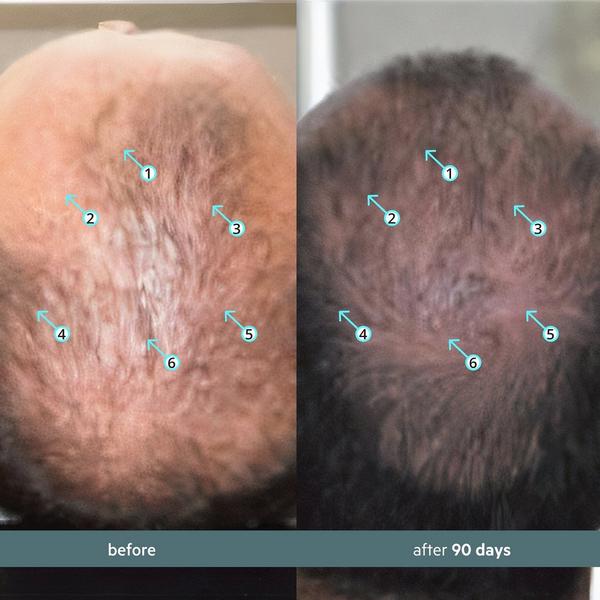 DS Laboratories Spectral.CBD Hair Serum with CBD + Nanoxidil 5% #5