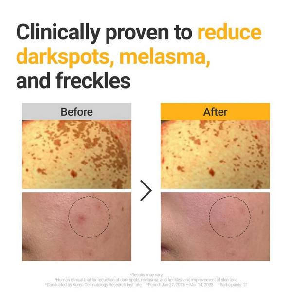 Rovectin Vita Dark Spot Serum #6
