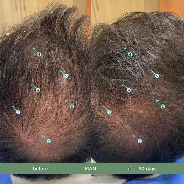 DS Laboratories Revita.CBD Super Antioxidant Hair DENSITY CBD Conditioner #5