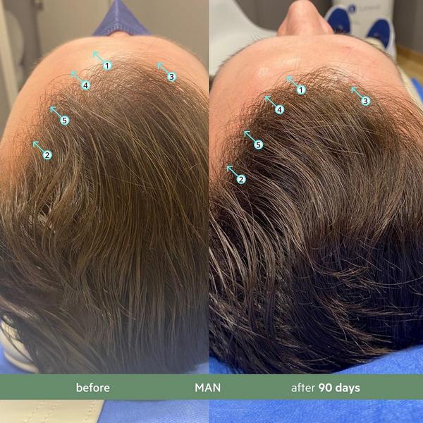 DS Laboratories Revita.CBD Super Antioxidant Hair DENSITY CBD Shampoo #5