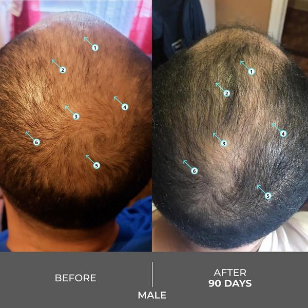 DS Laboratories Revita Extra Strength Hair DENSITY Shampoo #5