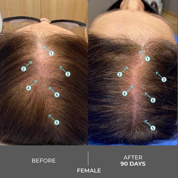 DS Laboratories Revita Extra Strength Hair DENSITY Shampoo #6