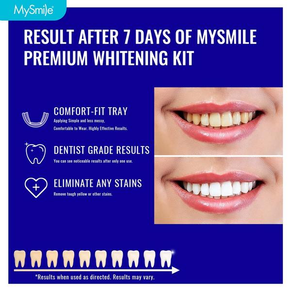 MySmile Prefilled Teeth Whitening Trays Kit, 12% Hydrogen Peroxide #2