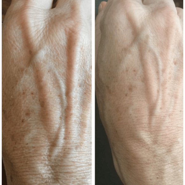 LuminaNRG Numiere Glow LED Hand Mask #3