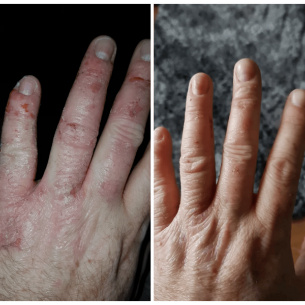 LuminaNRG Numiere Glow LED Hand Mask #4