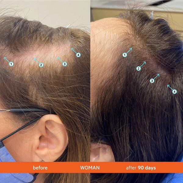 DS Laboratories Revita Tablets For Hair Growth Support #5