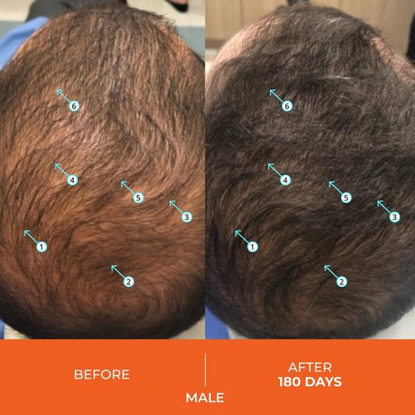 DS Laboratories Revita Gummies For Hair Growth Support #5