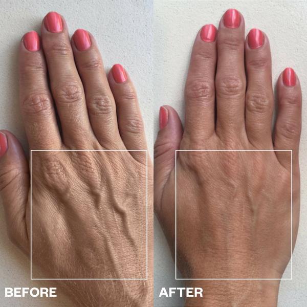 Wrinkles Schminkles Hand Wrinkle Patches #3