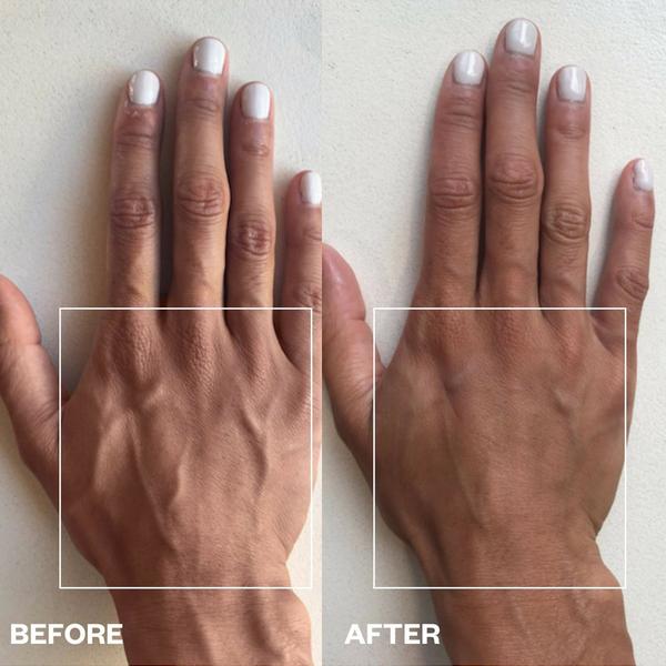 Wrinkles Schminkles Hand Wrinkle Patches #5